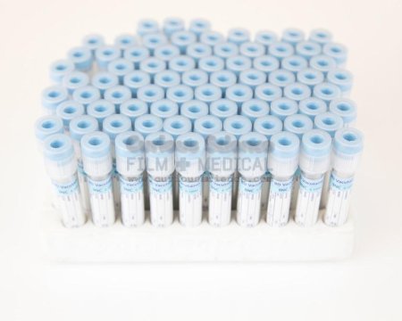 Vacutainer Sample Tray